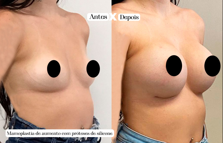 proteses copiar 2